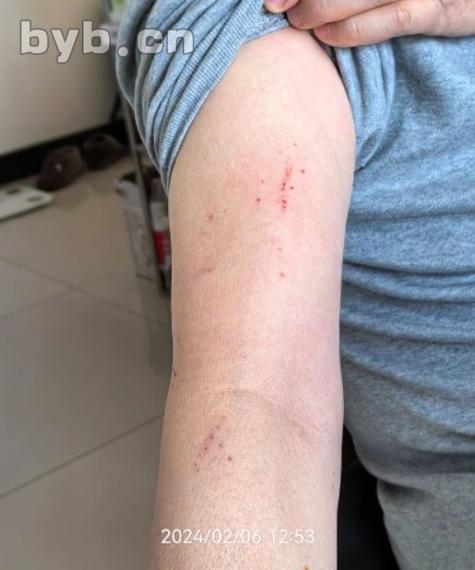 哈兰德：我背上很多抓痕，女朋友不太高兴父亲教我不能假摔